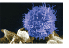 Autoreactive T cell
